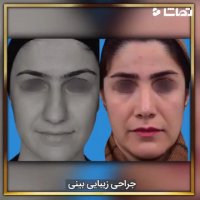 نمونه کار جراحی زیبایی بینی