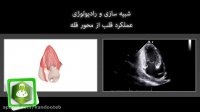 شبیه سازی و رادیولوژی عملکرد قلب از محور قله