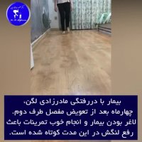 درمان قطعی دررفتگی مادر زادی لگن در مدت کوتاه