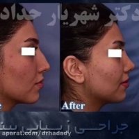 فیلم جراحی بینی!