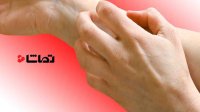 چرا بدنمان خارش می گیرد؟