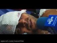 حمله پلنگ به جوان روستایی در شهرستان گرگان