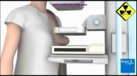 ماموگرافی چگونه انجام می شود؟