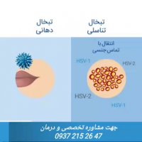 تبخال تناسلی چیست؟؟