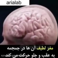 سندرم لرزان در نوزادان