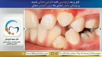 ارتودنسی غرب تهران | دکتر داوودیان