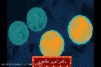 علائم سرطان معده | دکتر امیر طاهری