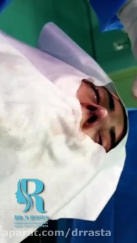 صفر تا صد جراحی بینی