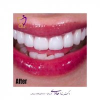 صاحب لبخندی زیبا باشید