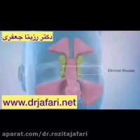 فیلم سينوزيت چگونه ايجاد ميشود؟