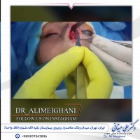 جراحی ترمیمی بینی