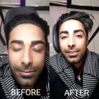 میکروبلیدینگ ابرو آقایان