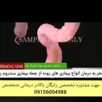 علائم روده تحریک پذیر چیست.؟