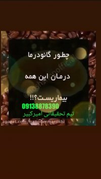 تقویت سیستم ایمنی