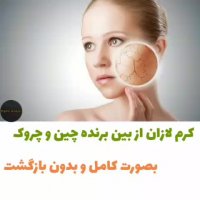 کرم لازان و درمان قطعی لکه های پوستی