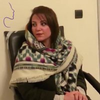 نتیجه رضایت بخش بیمار بعد از جراحی بینی