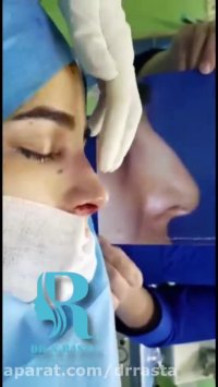 فیلم جراحی بینی در خانم جوان