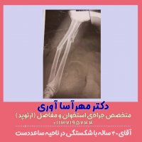 عمل جراحی شکستگی ساعد دست