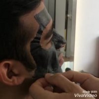 بلک ماسک کیس بیوتی