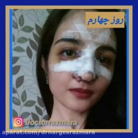 عمل زیبایی بینی