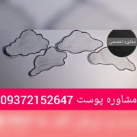 درمان قطعی ملاسما و لکه های پوستی توسط کرم لازان