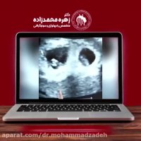 سونوگرافی دو قلویی