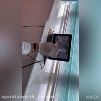 عصب کشی از تک کانال تا چهار کانال با پرکردن