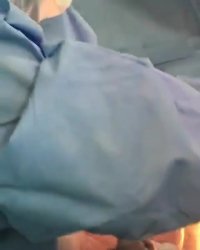 فیلم واقعی عمل سزارین