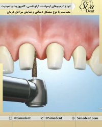 درمان های دندانپزشکی | دندانپزشکی سیمادنت