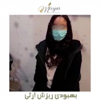 بهبودی ریزش مو ارثی بیمار عزیزمون