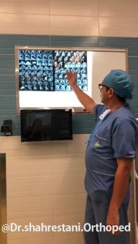 جراحی تعویض مفصل شانه