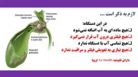 پیشگیری و درمان سنگ کیسه صفرا