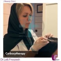 کربوکسی تراپی در کلینیک دکتر فروزش ( پارت 1 )