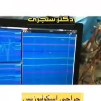 فیلم جراحی اسکولیوزیس