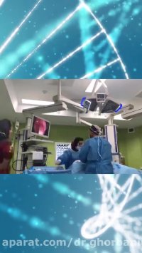 جراحی آندوسکوپیک سینوس