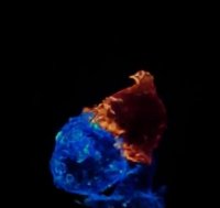 درگیری لنفوسیت تی کشنده (نارنجی) با سلول سرطانی