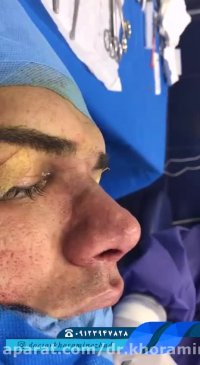 فیلم عمل بینی