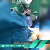 علت آرتروز زانو و جراحی در سن پایین؟