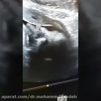 فیلم سونوگرافی صورت جنین