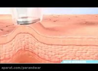 دستگاه جوان سازی پوست با مکش و میکرودرم ترنس دار