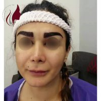 فیلم واقعی کاشت ابروی طبیعی