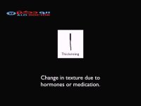 انواع موخوره و روش های درمان آن