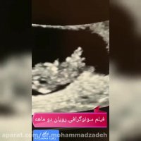 فیلم سونوگرافی