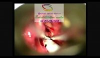 جراحی حنجره در برترین مراکز البرز 09121623463|گفتار توان گستر البرز