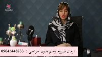 درمان فیبروم رحم
