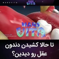 ارتودنسی دندان-دکترمجیدقیاسی دندانپزشک زیبایی مشهد