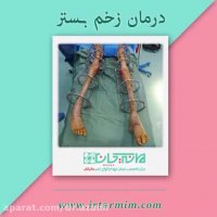 درمان زخم بستر