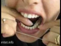 استفاده از نخ دندان ضروری است