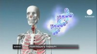 درمان جدید علایم بیماری پارکینسون را کاهش می دهد