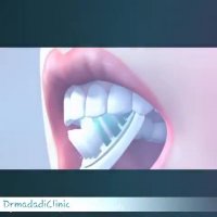 نحوه صحیح مسواک کردن دندان ها